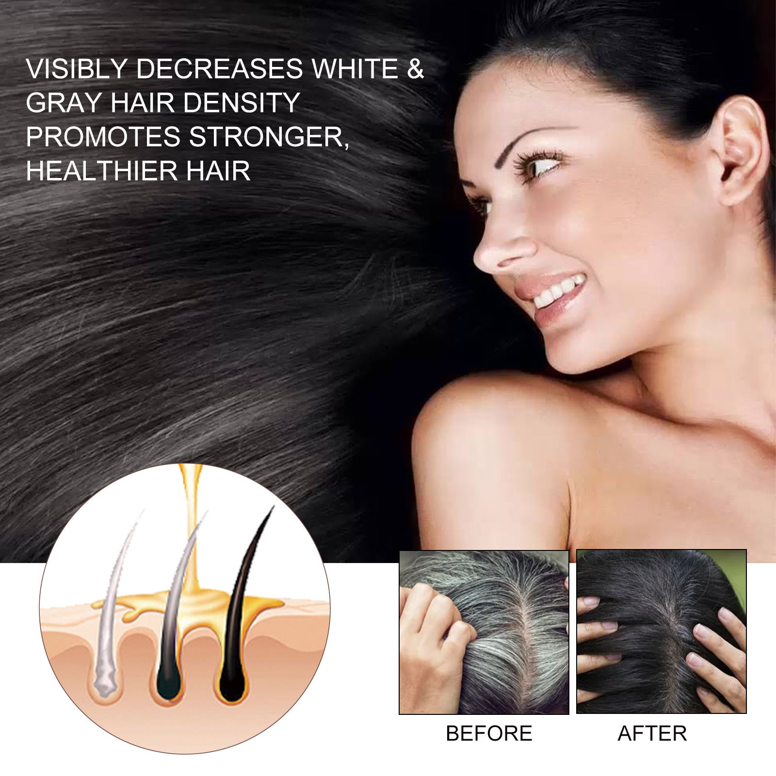 EELHOE Hair Dense Essence Hair Anti-hair Loss And Hair Fixation Nutrition 1d0dd5-b6.myshopify.com