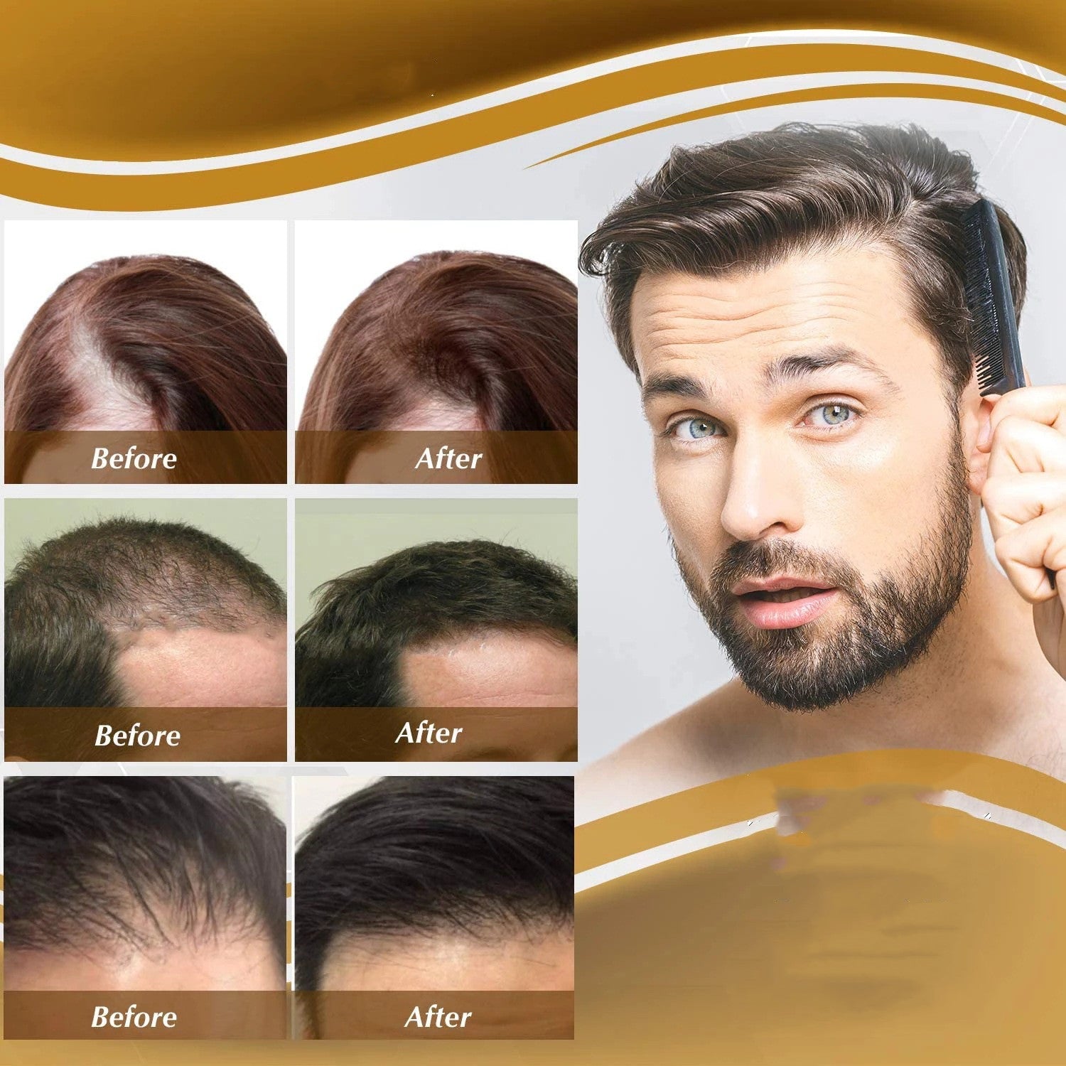 Anti Hair Loss Hair Nourishing Liquid Hair Firming And Hair Increasing 1d0dd5-b6.myshopify.com