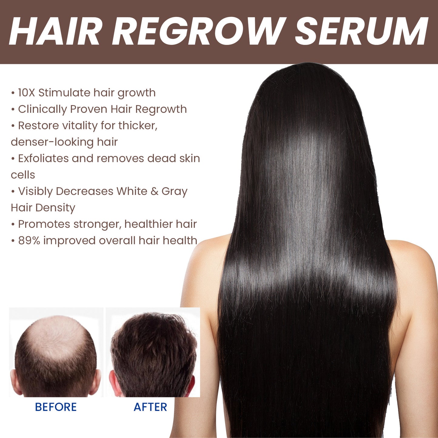 EELHOE Hair Dense Essence Hair Anti-hair Loss And Hair Fixation Nutrition 1d0dd5-b6.myshopify.com