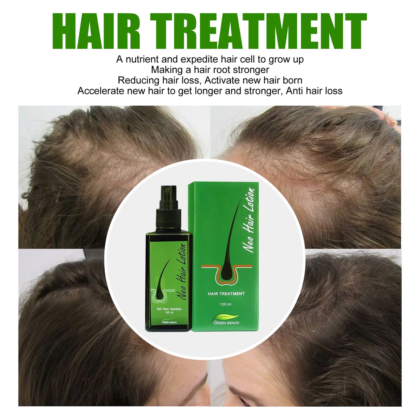 Hair Care Growth Lotion Spray 1d0dd5-b6.myshopify.com