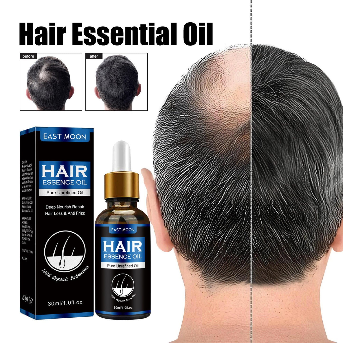 East Moon Men's Dense Hair Essence Strong Nutrition 1d0dd5-b6.myshopify.com