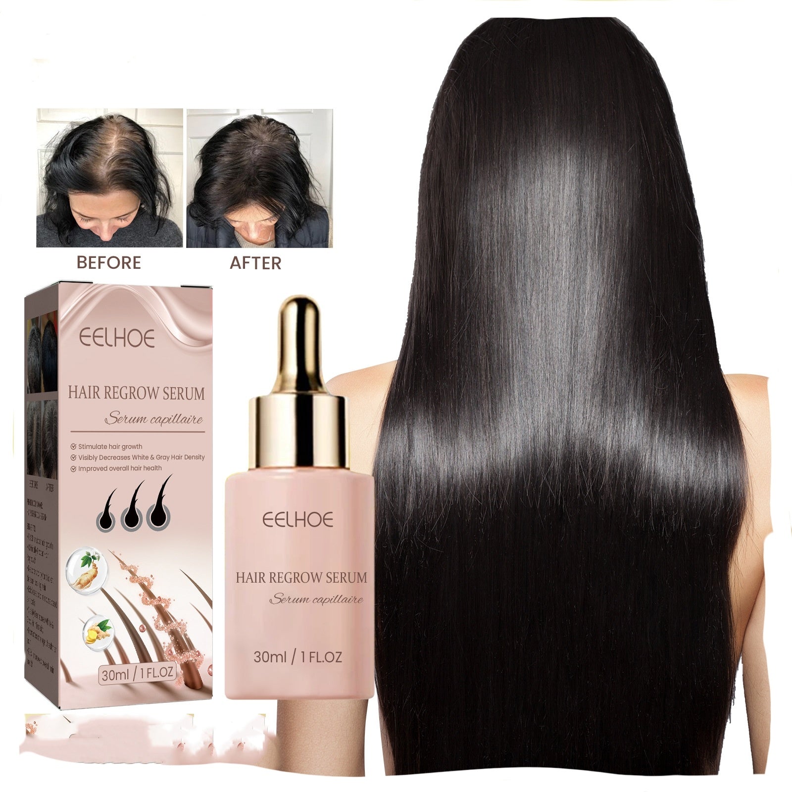 EELHOE Hair Dense Essence Hair Anti-hair Loss And Hair Fixation Nutrition 1d0dd5-b6.myshopify.com