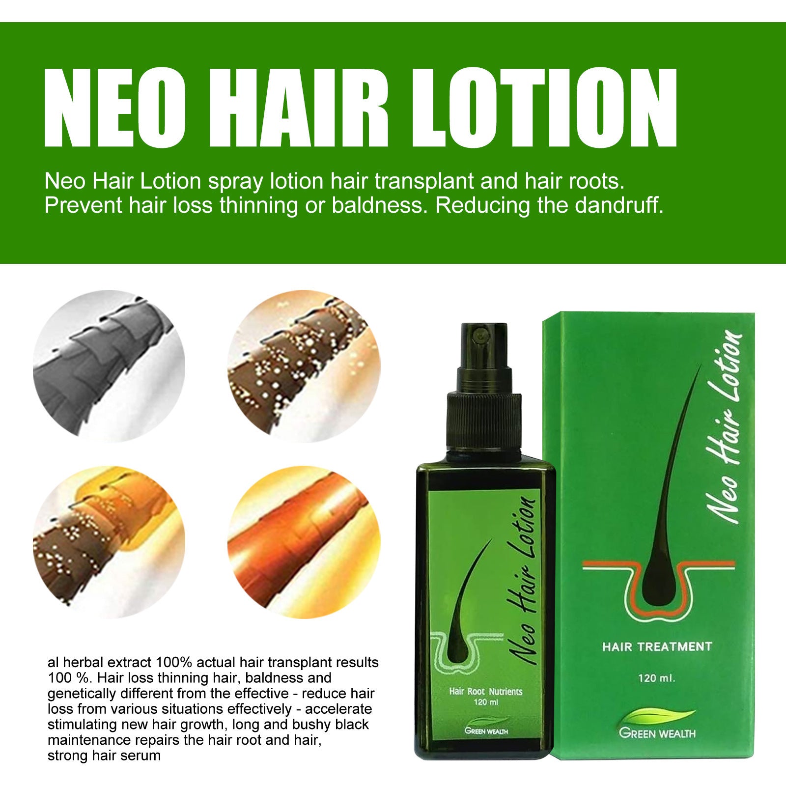 Hair Care Growth Lotion Spray 1d0dd5-b6.myshopify.com