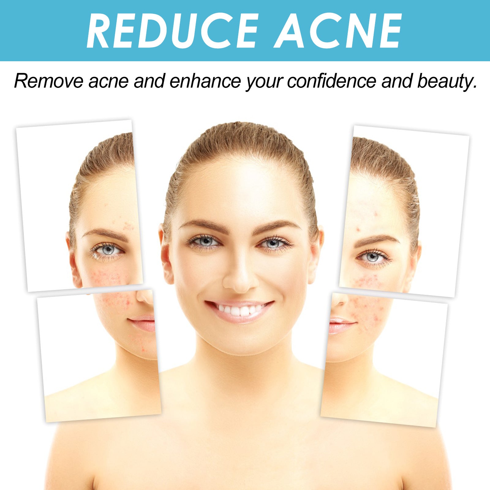 Salicylate Acne Repair Gel 1d0dd5-b6.myshopify.com