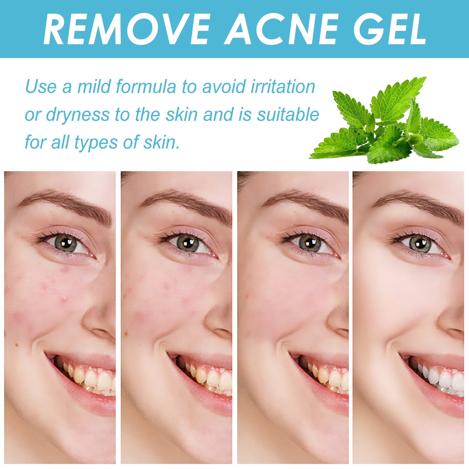 Salicylate Acne Repair Gel 1d0dd5-b6.myshopify.com