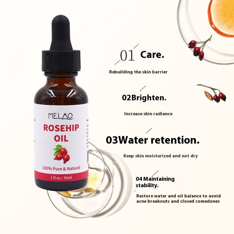 30ml Rosehip Oil Unisex Moisturizing 1d0dd5-b6.myshopify.com